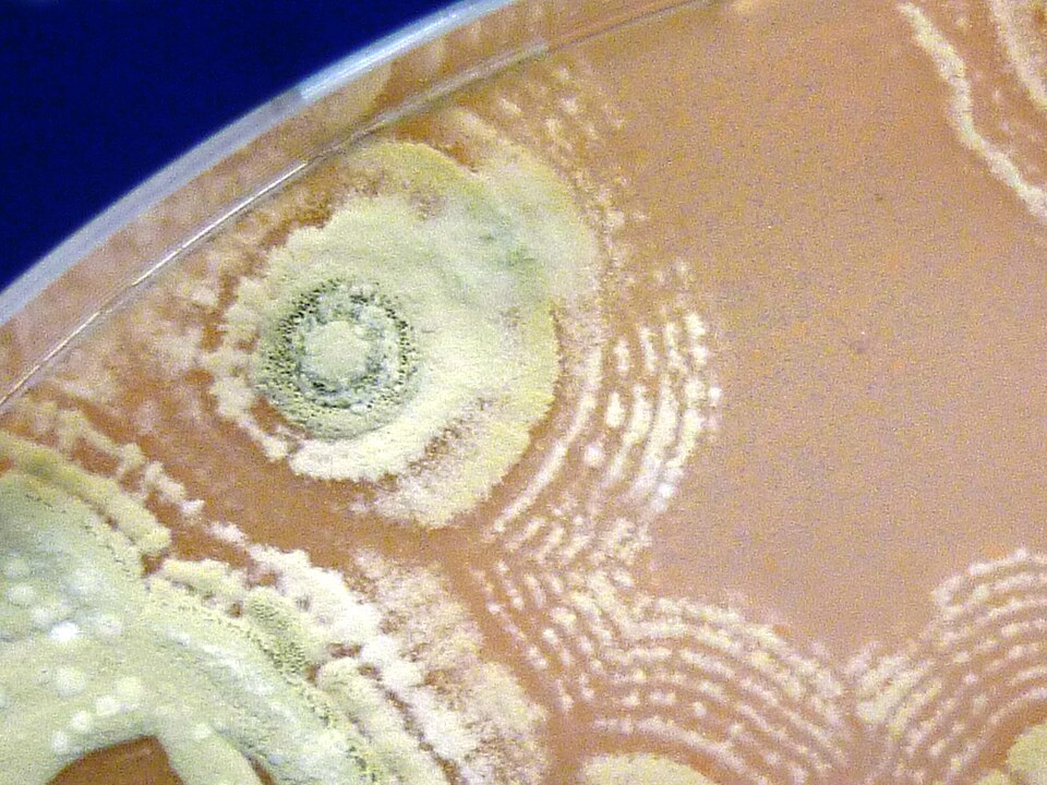 Photo of Actinomycetes