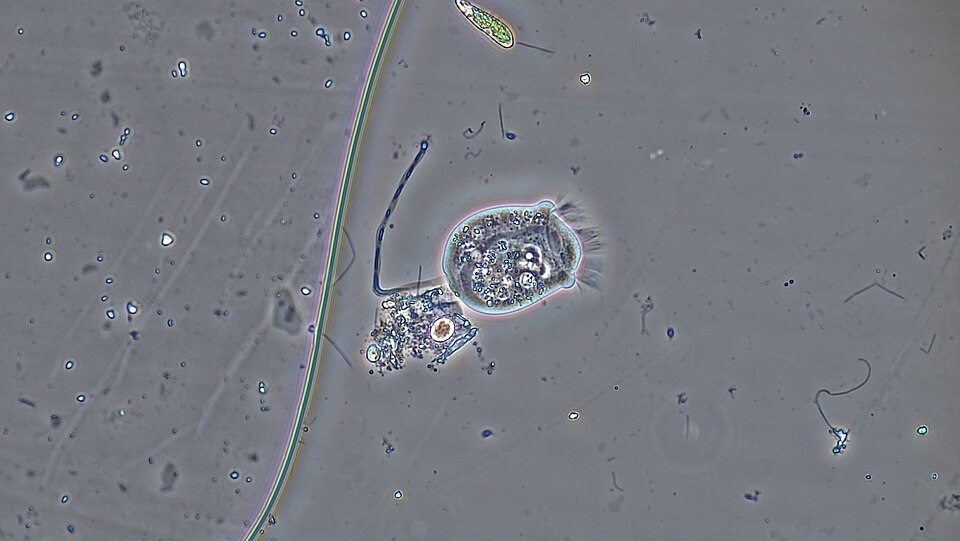Photo of Protozoa
